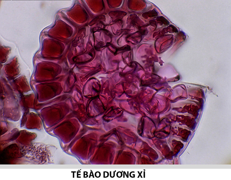 Tế bào dương xỉ quan sát được dưới kính hiển vi kỹ thuật số